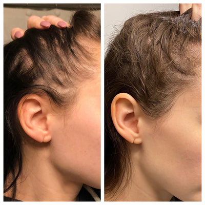 Hair Support Strips