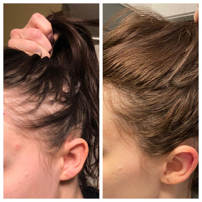 Hair Support Strips