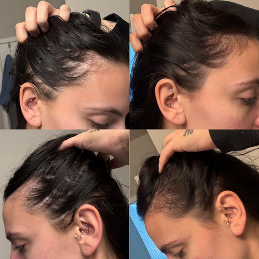 Hair Support Strips