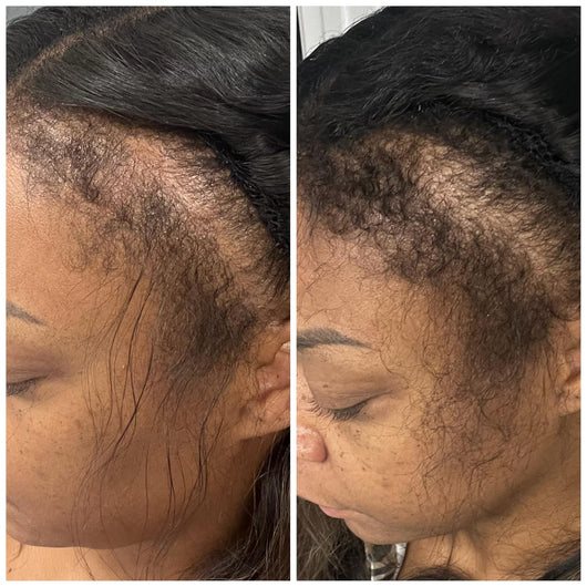 Hair Support Strips