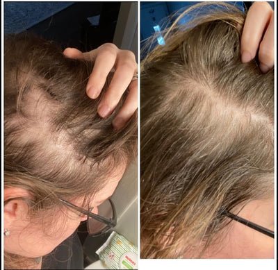 Hair Support Strips